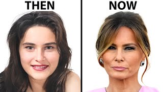 Melania Trump's NEW FACE | Plastic Surgery Analysis