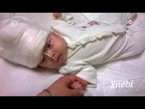 Vážne chorá Milotka musí nosiť prilbu (V SIEDMOM NEBI)