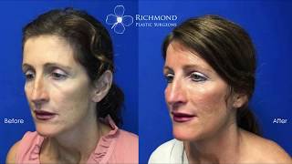 Richmond Plastic Surgeons