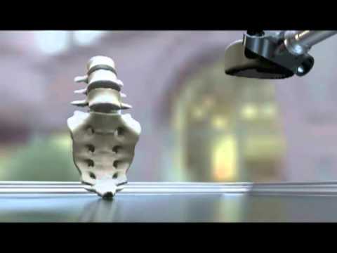 Anterior Lumbar Interbody Fusion Procedure