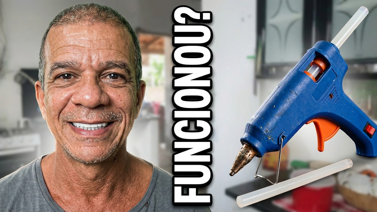 A faceta dentária instantânea pra quem está longe da civilização como eu estou