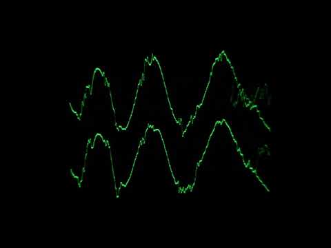 chess type beat (slowed) [no reverb]