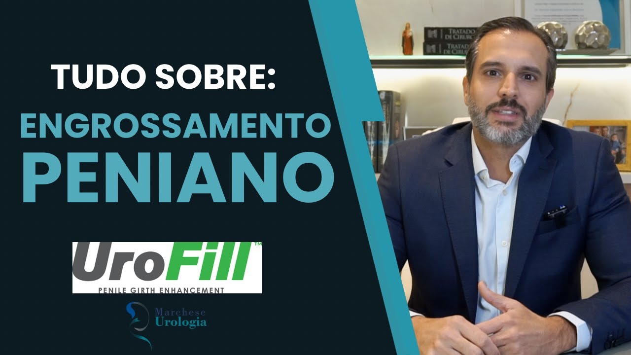 Thumbnail do vídeo