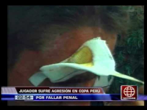 América Noticias: Martín Dall'orso de Fuerza Minera fue agredido brutalmente por fallar un penal