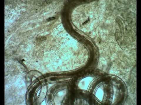 hymenolepidosis invázió forrása rossz lehelet az E. coli miatt