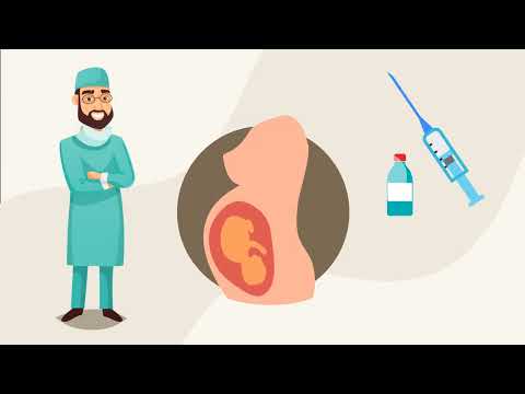 نموذج من الموشن جرافيك- الحملة الطبية للتخدير الآمن "الولادة دون ألم"