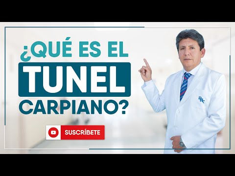 ¿QUÉ ES EL TÚNEL CARPIANO?