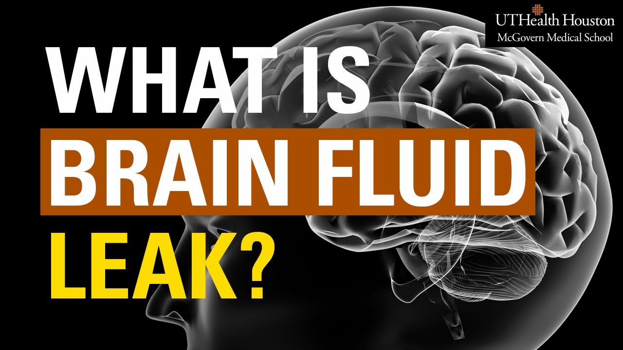 How long does a CSF leak take to heal? Tipseri