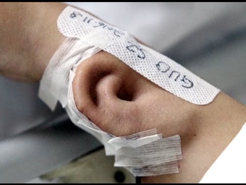 คลิกเพื่อดูคลิปวิดีโอ