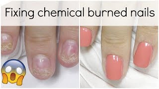 Extremely damaged nail transformation - How to fix it with Polygel