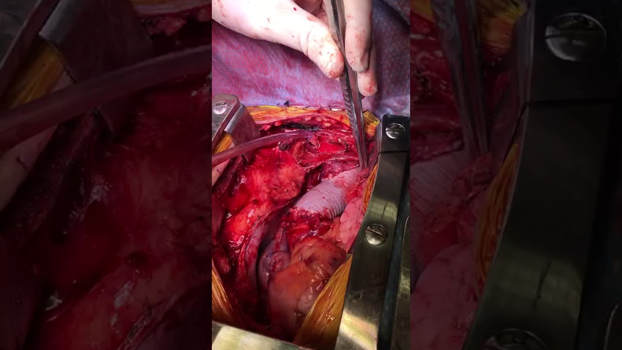 Eduardo Celedon Lavin-12