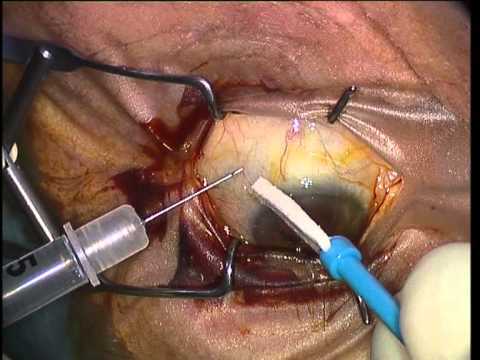 Addormentarsi con una maschera su una faccia Il collo di persona di mesolifting