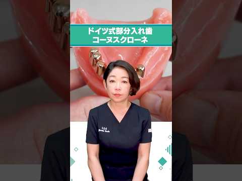 ドイツ式部分入れ歯 コーヌスクローネ