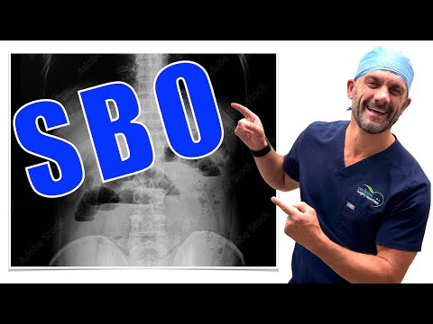 How I Diagnose Bowel Obstruction!