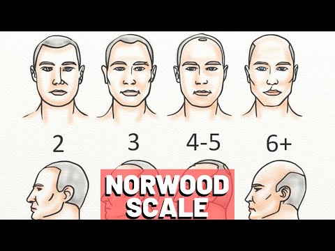download lagu mp3 mp4 Norwood Scale 2 Examples, download lagu Norwood Scale 2 Examples gratis, unduh video klip Norwood Scale 2 Examples