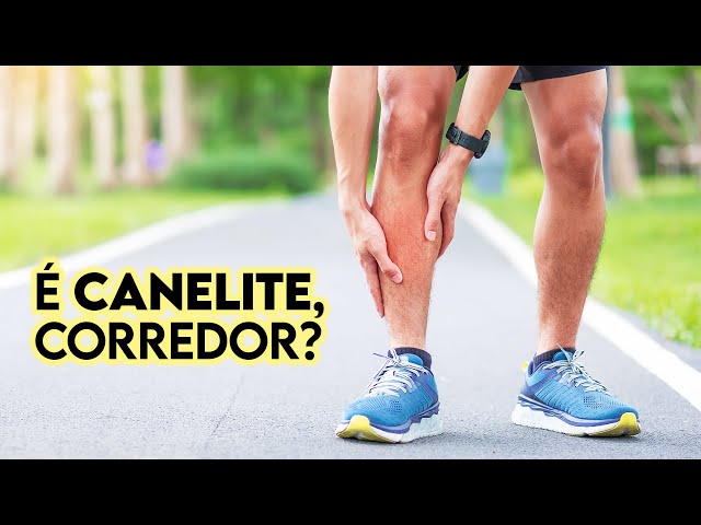 É  CANELITE, corredor? Ft. Raquel Castanharo