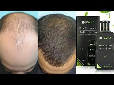 download lagu mp3 mp4 Dexe, download lagu Dexe gratis, unduh video klip Dexe