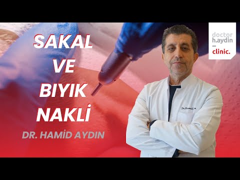 Sakal ve Bıyık Nakli - Dr. Hamid AYDIN