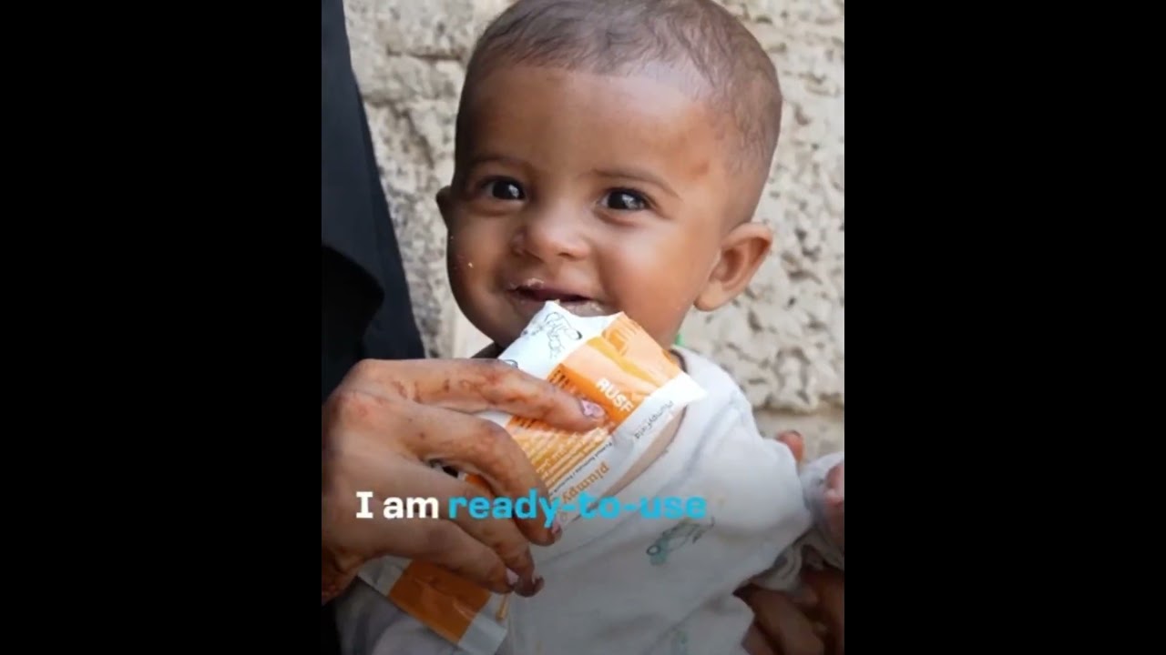 Be a monthly donor and save lives, send Ready-to-Use Therapeutic Food (RUTF) to children in need.