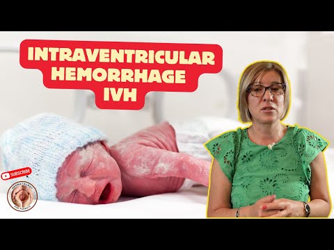 Intraventricular hemorrhage IVH