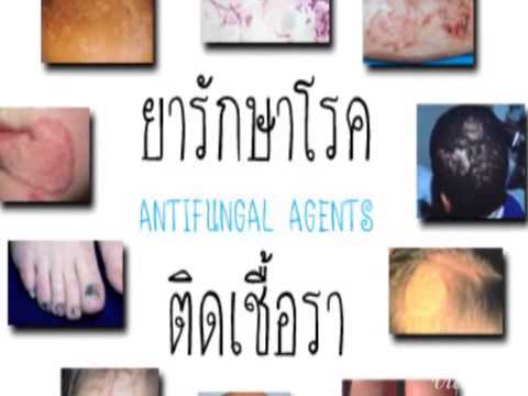 การรักษา Blagoveshchensk ของโรคสะเก็ดเงิน ติสโรคสะเก็ดเงิน