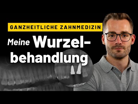 Darum habe ich meine wurzelbehandelten Zähne entfernen lassen! 3 Tage bei Dr. Dominik Nischwitz