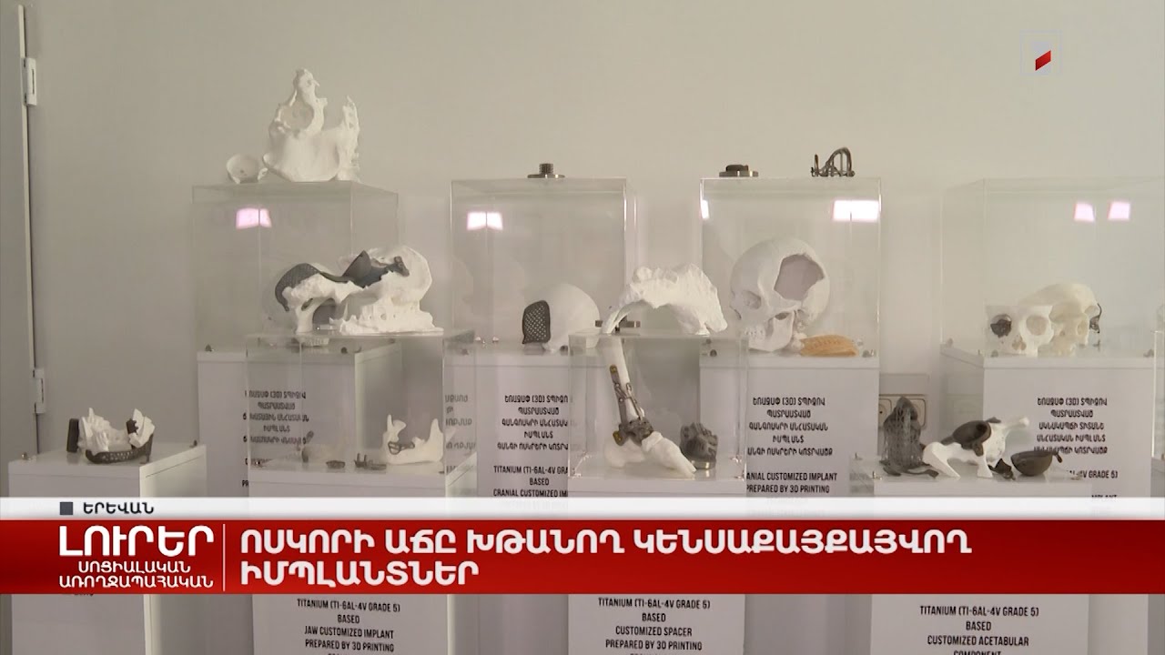 Ոսկորի աճը խթանող կենսաքայքայվող իմպլանտներ