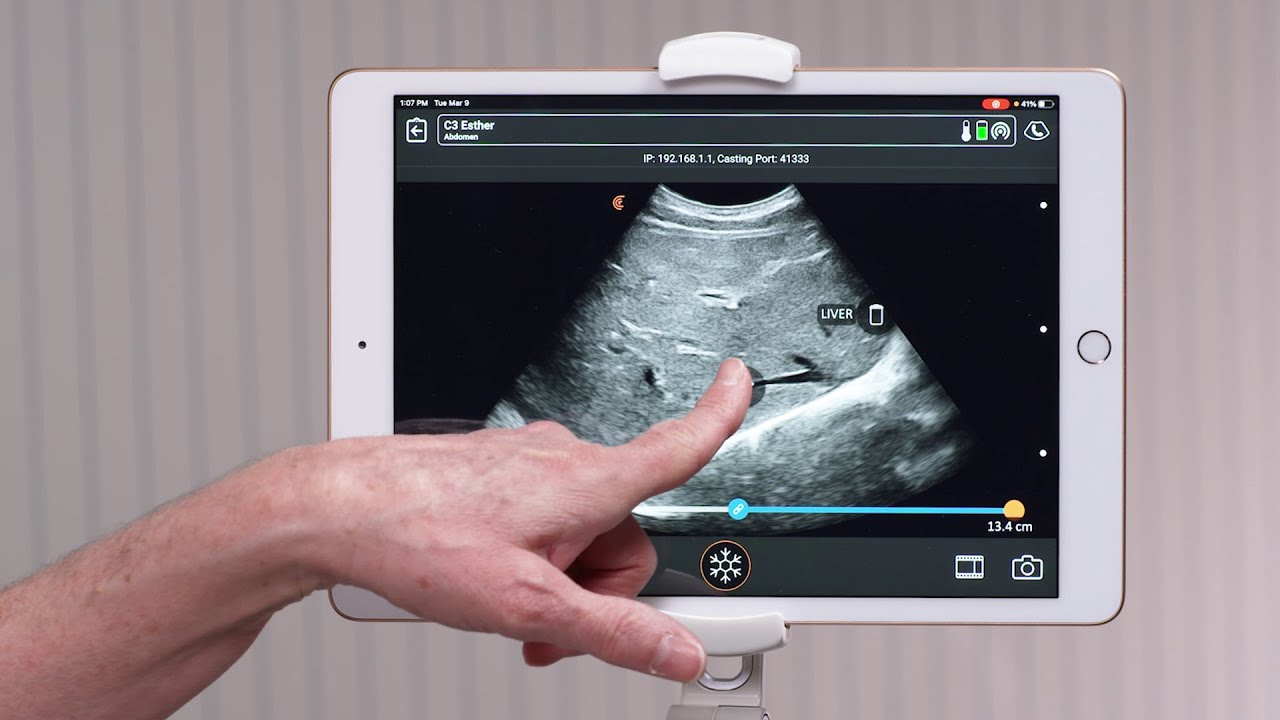 Clarius Feature: Annotations