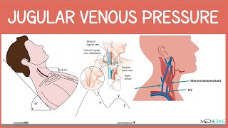Jugular Venous Pressure (JVP) Physiology, Waveforms, Examination and Interpretation Made Easy