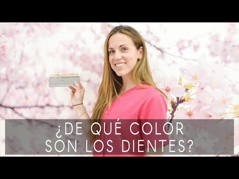 ¿De qué color son los dientes?