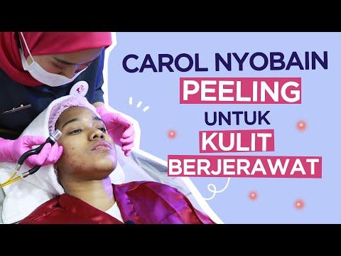 download lagu mp3 mp4 Cara Menghilangkan Bekas Jerawat Treatment, download lagu Cara Menghilangkan Bekas Jerawat Treatment gratis, unduh video klip Cara Menghilangkan Bekas Jerawat Treatment