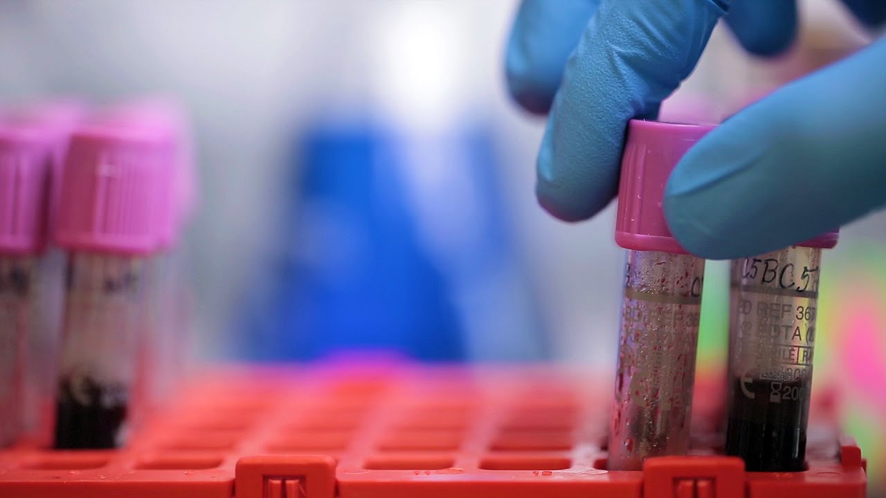 First Ever Test for IBS | Cedars-Sinai