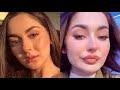 Lip Surgery Injection Lip Surgery Actress Lip Surgery For Pink Lips Lip Surgery Makeup