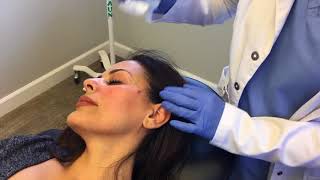 Nurse Claire: PDO Thread Lift  / Miracu