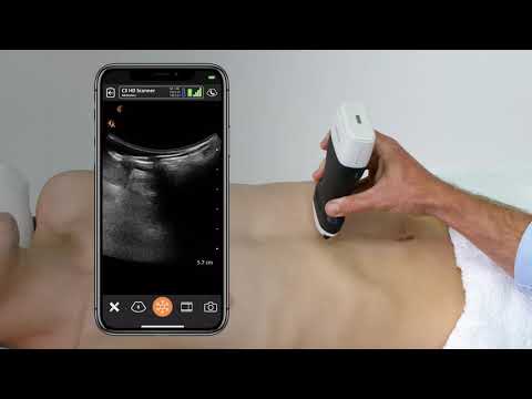 Abdominal Aortic Aneurysm (AAA): Ultrasound Scanning Technique
