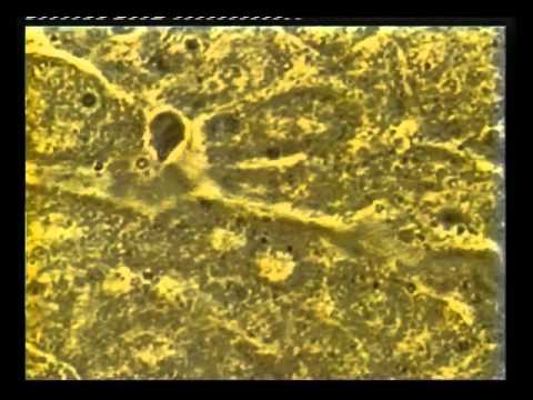 Effect of BEMER on circulation in Liver