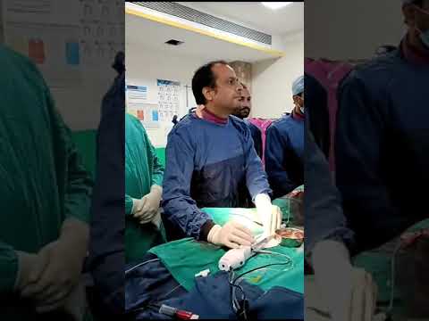 Rotablation of coronary artery #heartattack #angioplasty #stent #cholesterol