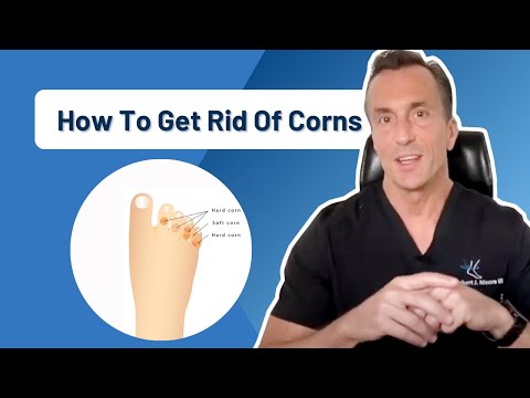 How Do You Get Rid Of Corns On Your Foot Permanently?
