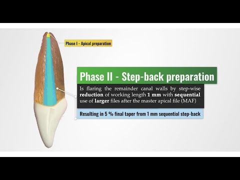 preclinical laboratory demonstration - cleaning and shaping - stepping back