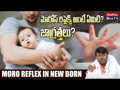 Moro Reflex - Everything You Need to Know i Must Watch For New Moms l Dr. Kusuma Akshay Kumar