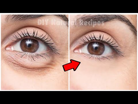 U samo 3 dana ova će krema za područje oko očiju u potpunosti ukloniti bore i natečenost