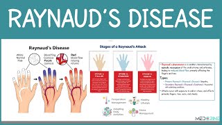 Raynaud’s Disease & Phenomenon | Complete Nursing & Medical Lecture (Causes, Symptoms, Management)