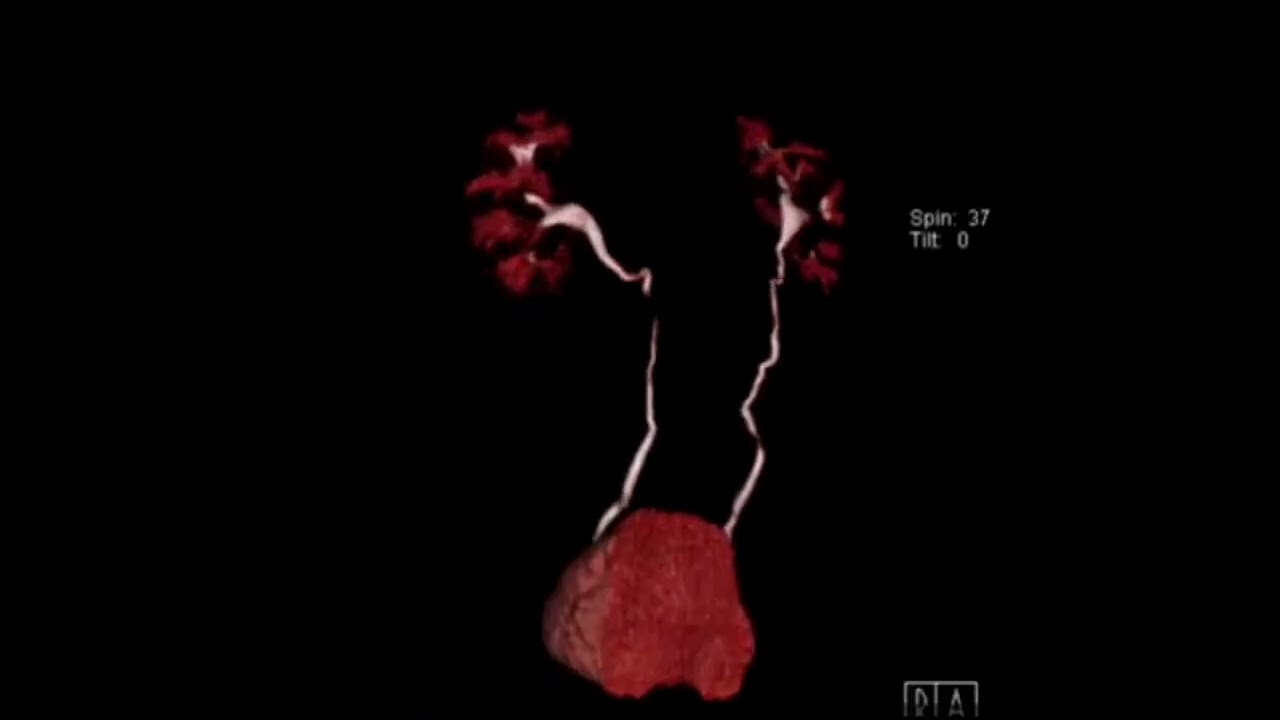 Nicolás Serrano Heredia-12