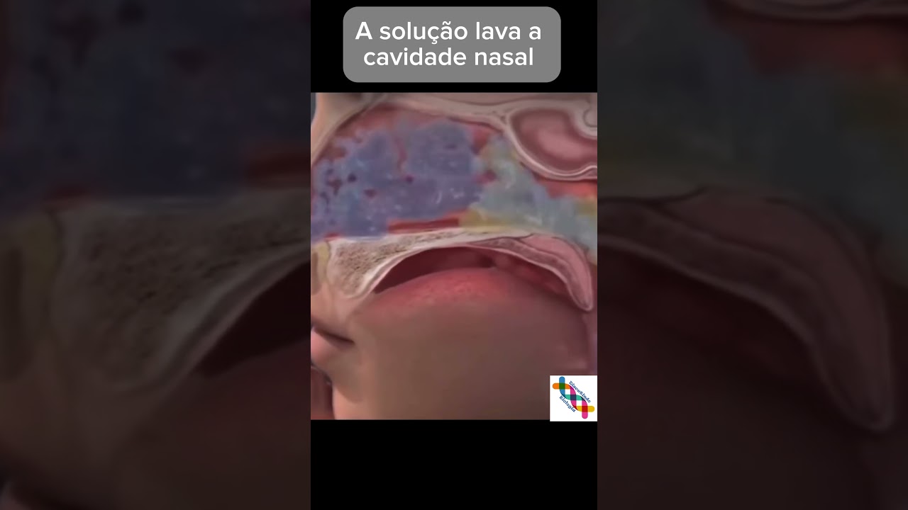 Importância da Lavagem nasal. #short #shorts #shortvideo #shortsvideo #biologia #medicina #enem #bio