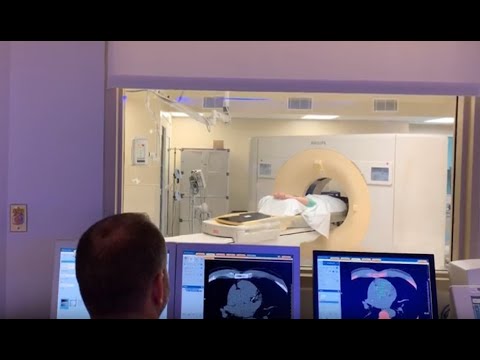 Coronary Calcium Scores: Determining Your Risk to Start Preventive Therapy