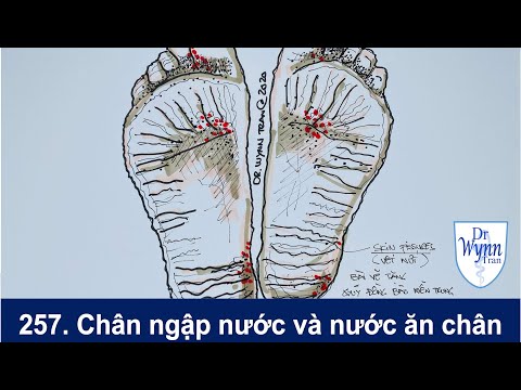 Chân ngập nước và nước ăn chân vùng lũ: cách ngăn ngừa và chữa trị