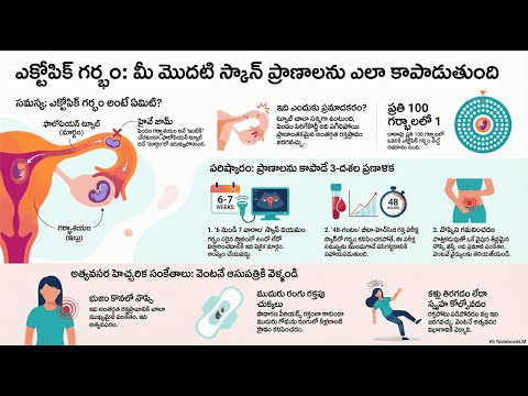 Ectopic Pregnancy — video thumbnail
