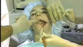 What Is An Oral Surgery Assistant? Oral Surgery Assistant Overview - Zippia