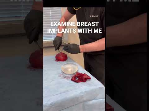 What Is Breast Implant Removal Surgery?