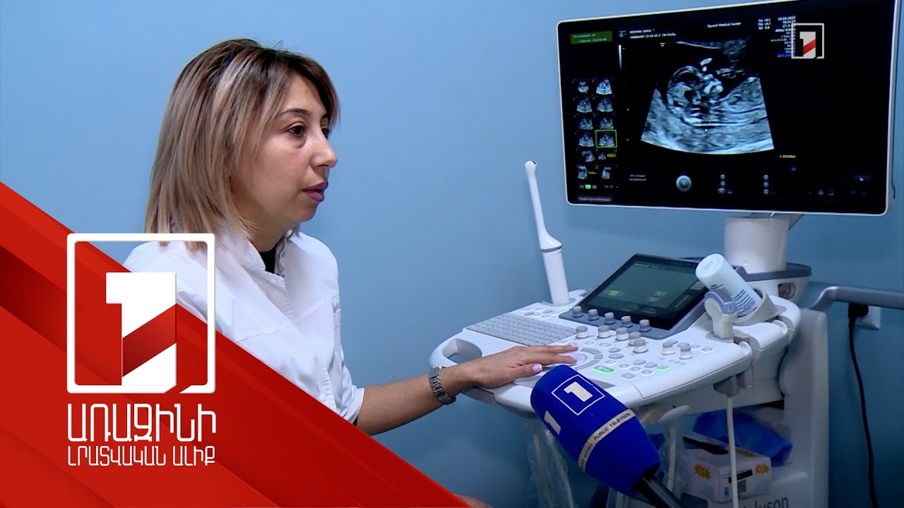 Շիրակի մարզում հղիներն այսուհետև կարող են անվճար ենթարկվել սքրինինգային հետազոտության